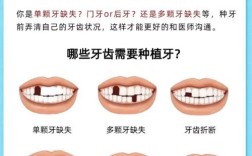 种牙怎么不可以分期