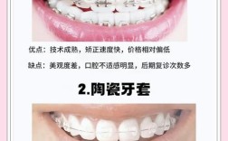 牙齿手术矫正有哪些常见种类？不同类型适用哪些牙齿问题？