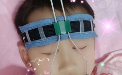 正畸牵引牙齿疼吗