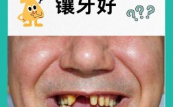 老年人不种牙真的可行吗？长期缺牙对身体和日常生活会带来哪些潜在影响？