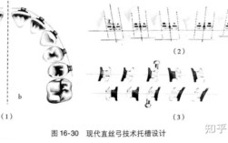 长沙天天正畸托槽图谱详细介绍了哪些托槽类型，对正畸患者选择托槽有何实际指导意义？