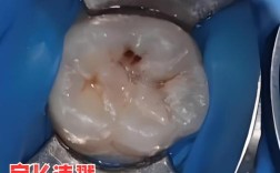 蛀牙很多能矫正牙齿吗