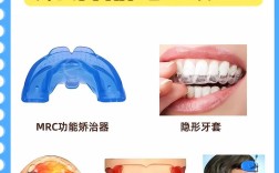 矫正牙齿器品种有哪些？常见类型有何区别？