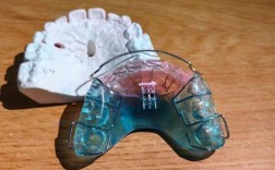 唇弓错位修复用什么方法？不同错位情况如何选择修复方案？