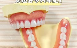 嘉善种牙的材质哪种好