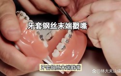 正畸保护蜡怎么用？正确使用步骤是什么？