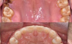 哈尔滨医大一正畸效果好不好？值得信赖吗？