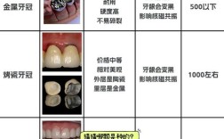 种牙牙冠材质哪种更好？如何选择适合自己的？