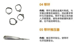 正畸治疗中常用的正畸钳有哪些？