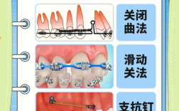 零基础学正畸方法
