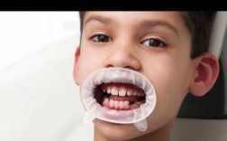 义获嘉开口器的使用方法