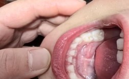 牙齿没换完能矫正吗？