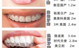 成人矫正牙齿需要多钱