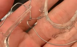 单个牙齿矫正效果如何？适合哪些人？