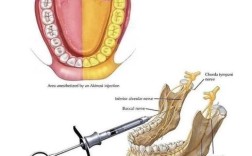 牙周膜麻醉方法视频中详细演示了哪些操作步骤？新手医生如何快速掌握关键技巧并避免常见失误？