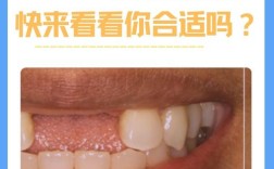 牙齿稀少能种牙吗