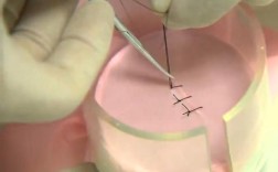 口腔常用缝合方法有哪些？如何选择合适的方法？