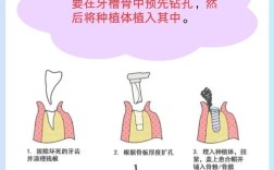 口腔种植治疗方法有哪些常见选择？