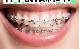 正畸有年龄限制吗