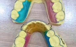 保持器 正畸 图片