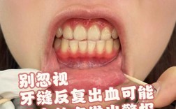 矫正牙齿期间牙龈出血，是什么原因引起的该怎么办？