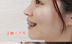 郑州牙齿矫正哪里做得最好？