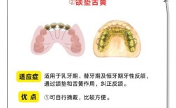 矫正地包天有那些方法