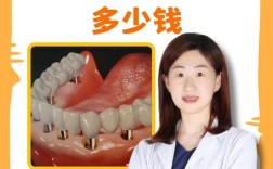 微笑广州免费种牙是真的吗？活动是否可信？