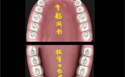 八种揭开髓室顶的方法