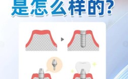 缺牙后种牙好还是牙冠好？哪种修复方式更适合？