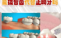 拔智齿综合科还是正畸