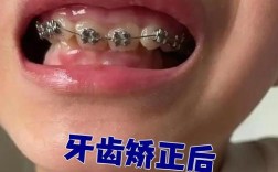 牙齿矫正后牙齿松动是正常现象吗？