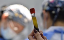 温州附属口腔医院种牙效果如何？价格贵不贵？