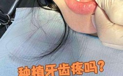 种牙麻药打哪里