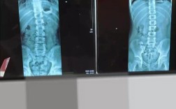 骨性正畸前后拍片