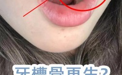 正畸拔牙后牙缝到底多久能完全闭合？受哪些因素影响，不同个体时间差异大吗？