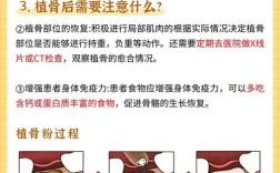 种牙植骨注意事项