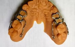 正畸随形弓图如何有效压低牙齿？