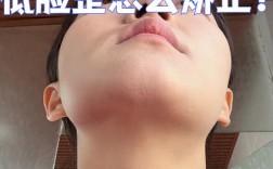 下巴高低不平，矫正牙齿能调整吗？