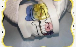 fr三型正畸技术