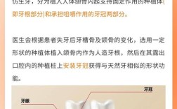 牙松动到几度适合种牙？种植牙的松动度标准是什么？