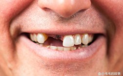 种牙后为何仍缺牙？原因解析与应对指南