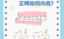 牙性深覆盖矫正方法有哪些？不同矫正方式的优缺点和适用人群是怎样的？