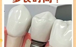 三颗牙可以一起种吗