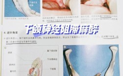 颌外局部麻醉常用方法及操作要点是什么？
