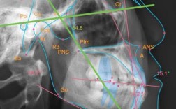 正畸头影测量图下载资源哪里找？