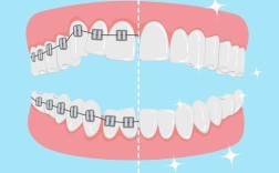 正畸尖牙中性关系标志