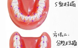 口腔脱敏治疗方法图解