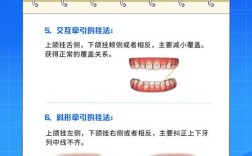 正畸牙齿橡皮圈怎么带