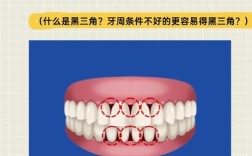 消除牙齿黑三角的有效方法有哪些？矫正、树脂贴面还是牙周治疗？哪种更适合不同情况的牙齿？